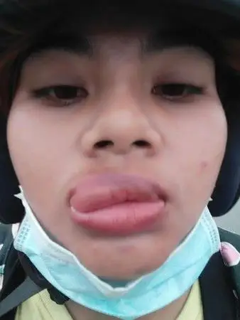 niz面对镜头表情相当无奈,只见她的下嘴唇看起来虽然有点肿,但还不至