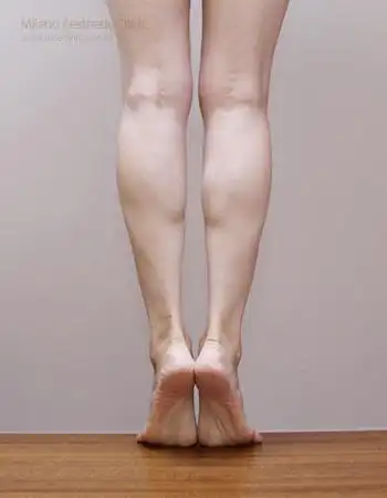 爱美小静久站萝卜腿成型,这次夏天决心瘦小腿