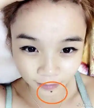 面相命理# 痣长在下巴正中间(地阁位置). 来自看相叔叔 - 微博