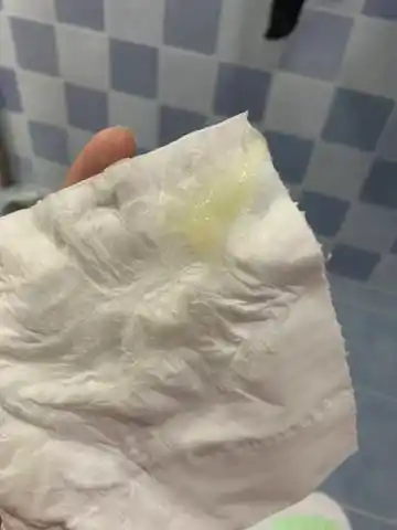 孕晚期分泌物增多,还会有特别粘稠的分泌物,也没有味道,像果冻一样