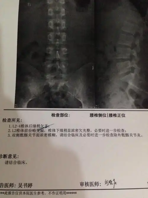 您好,本人由于健身两年,最近感觉腰椎不舒服,随即去协和医院拍