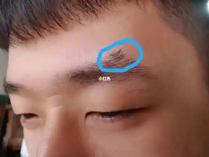 弟弟眉毛的一角怎么会翘起来这是什么眉型
