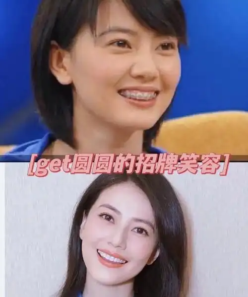 高圆圆矫正牙齿前后对比