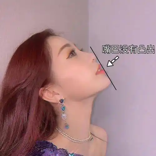 虞书欣式凸嘴圆脸变美思路