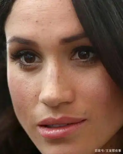 梅根很喜欢自己一脸雀斑,把它们比作夜空中的星星,做真实的自己