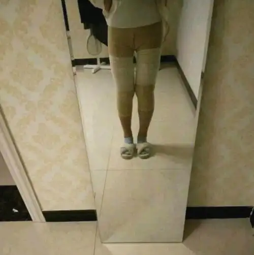 宝妈哺乳后胖了大腿根爆粗水动力大腿环吸术分享附攻略