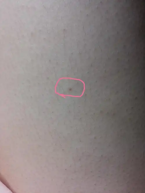 请问我的身上为什么会长这种红色小点点!这长一个那长一个的!