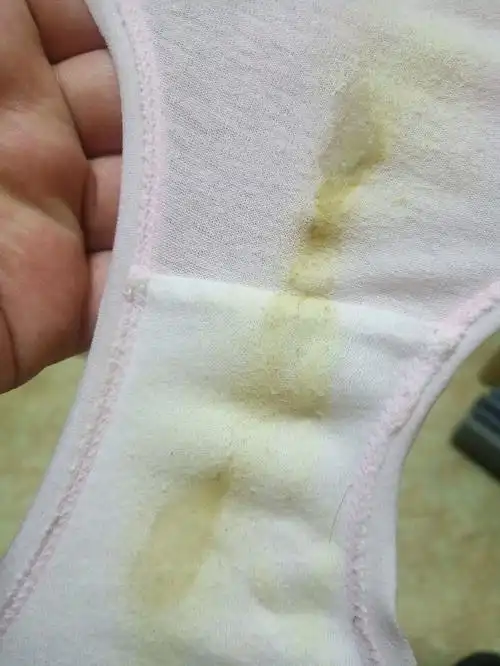 开始就发现自己白带发黄,一天一 | 妈妈网轻聊_千万女人的共同选择