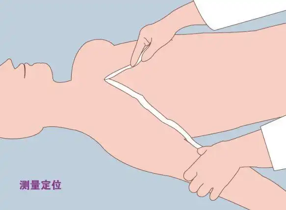 图文并茂轻松搞定picc置管那些事儿