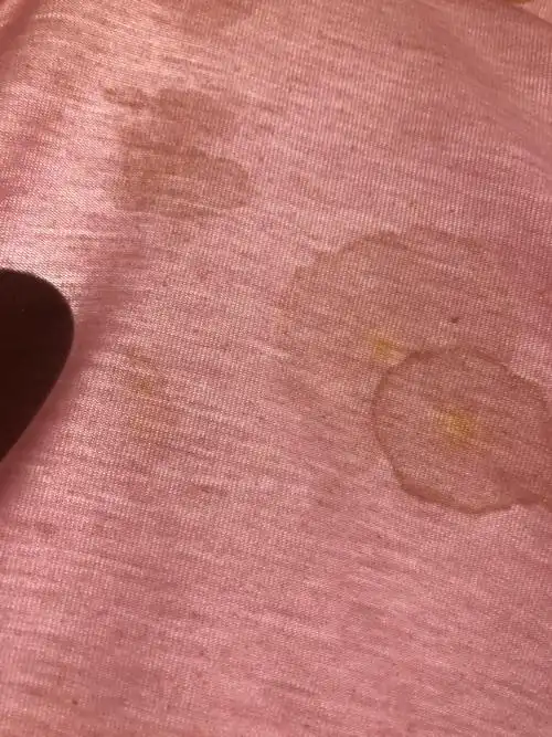 正常83% 不正常17%          331 人参与