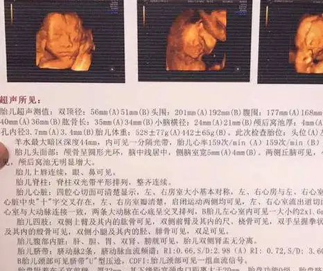 宝宝_孕妇_反应