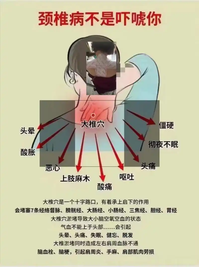 颈椎病不是吓唬你!
