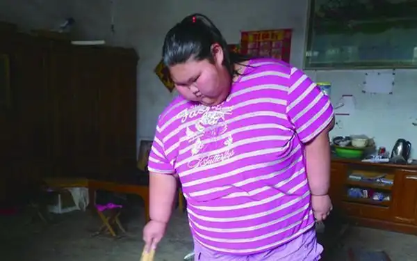山东一16岁女孩重330斤 儿童肥胖怎么办?