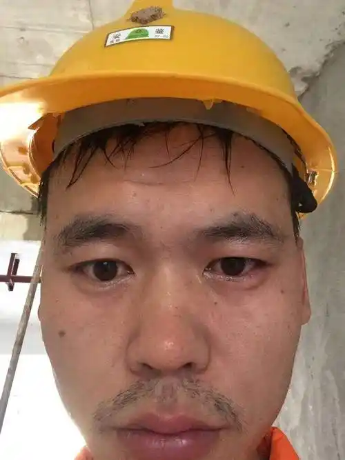 坐月子看手机眼睛疼怎么办 坐月子看手机眼睛疼怎么办呢