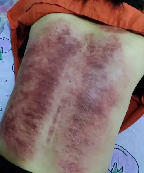 这像女人的后背吗?毒素如此之后,令人咂舌!