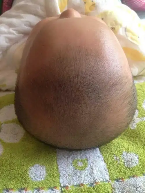 这也是正常的,不用紧张.