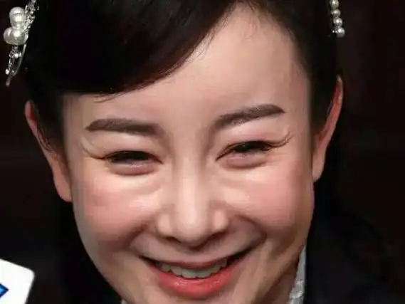 整容最失败的女星就属她, 现已把假体取出, 看到她你还敢整容吗?