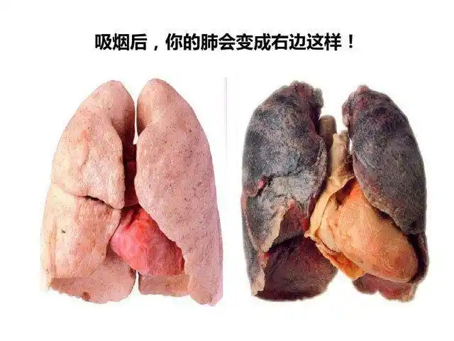 既然吸烟会伤肺,那么戒烟后,肺部的健康能不能恢复过来呢?