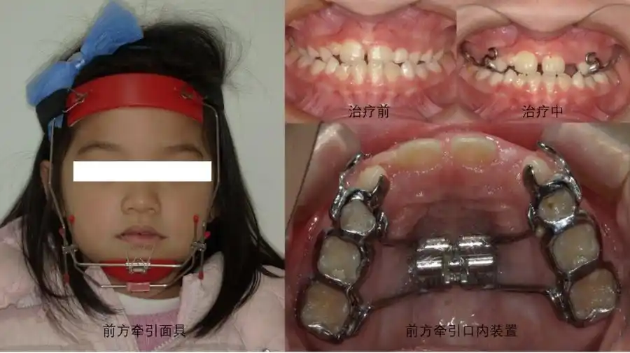 我的位置:>上观号>上海市儿童医院>文章详情>3.