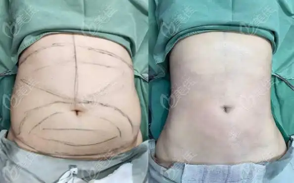 皮肤科,纹绣,中医科,配备医美行业内先进的医疗设备,雄厚的医生技术