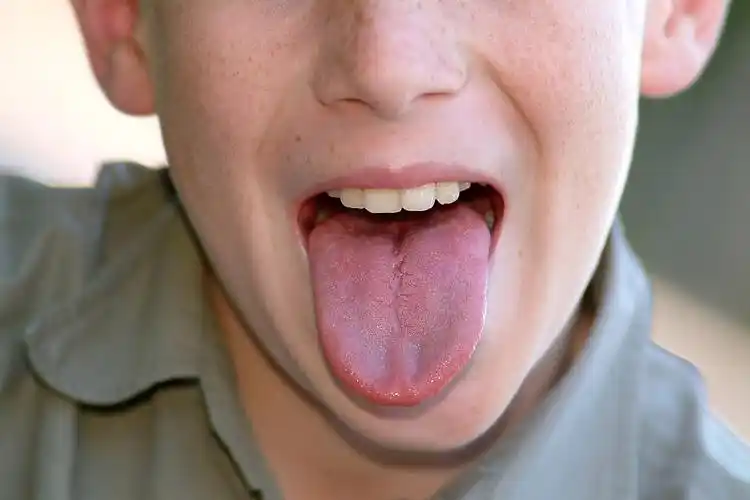 小男孩伸出舌头图片下载