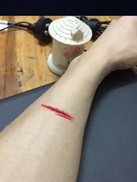 求ps大神帮忙p个小伤口在手上