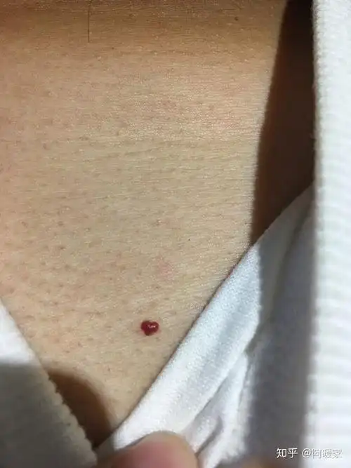 不可能…我在他胸口上只找到过一颗