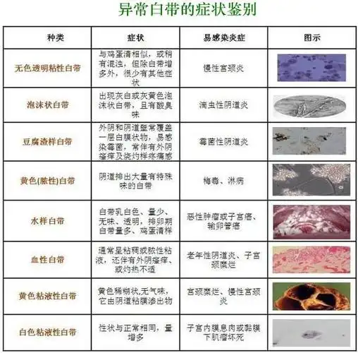 正常白带是什么样子的图片异常白带各种症状图片大全