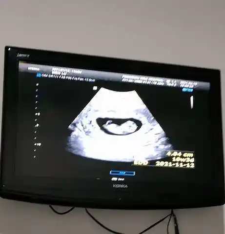 育儿问答 怀孕期 nt男孩女孩啊问题补充: 问题补充: 提问者