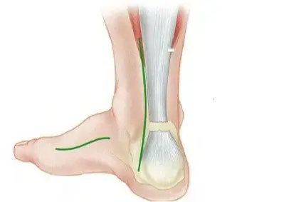 较真丨易建联因跟腱断裂退出cba总决赛这个病了解一下