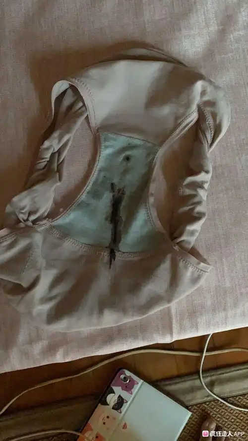 但昨天出血了.好担忧