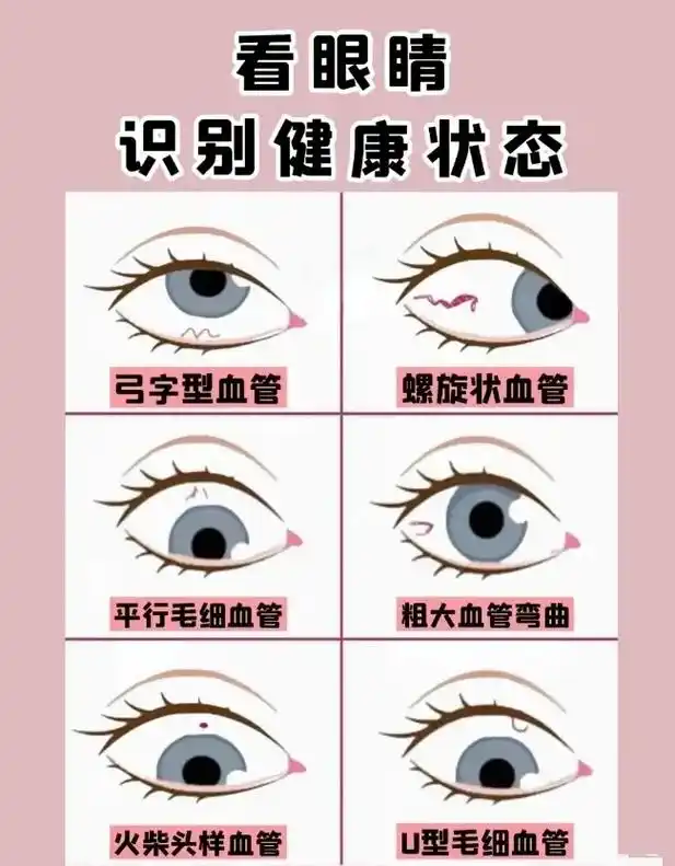 中医教你看眼睛98识别健康状态6015  98眼睛是我们平时使用