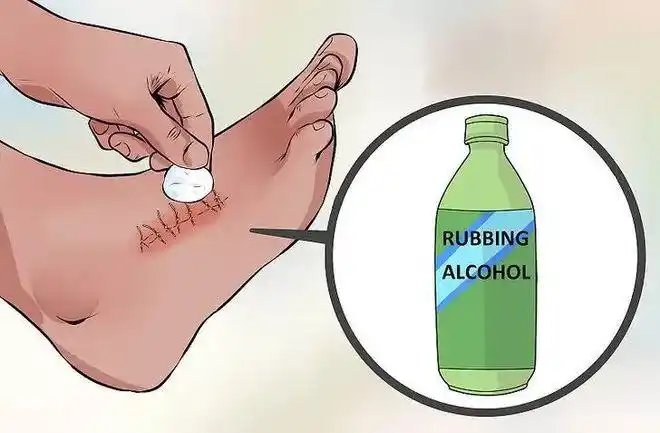 意外切割伤不要慌家庭医生专栏