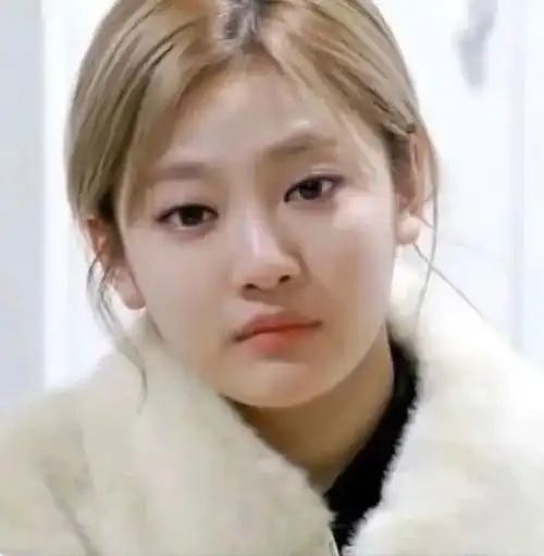 颈纹不除的每一天烦它