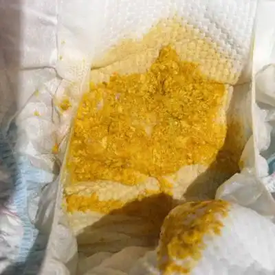 纯母乳餵养,这样的便便正常吧?出生排乾净胎便后,每天都是这样的便便.