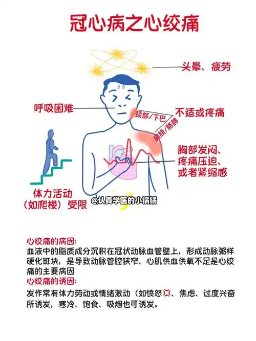 科普60冠心病之心绞痛症状病因和zhi疗