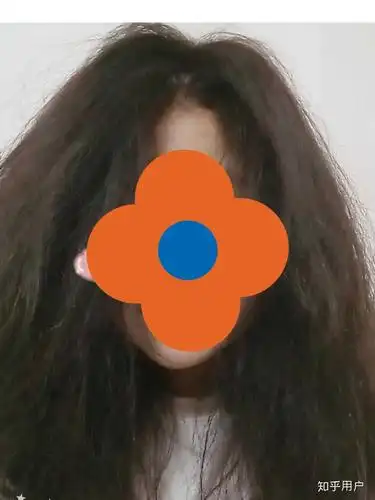 头发「自来卷」是怎么产生的?