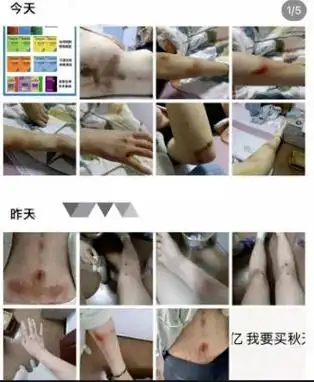 21岁女孩被12岁男童性侵撕衣摸胸全身淤青太变态了