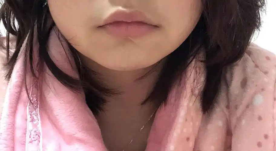 嘴角向下怎么办