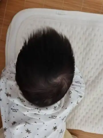 请问这是舟状头吗怎么调整啊