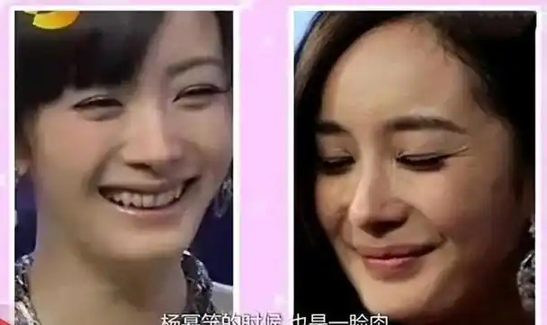 "嘴巴不好看"太给颜值减分!这7位女星貌美如花,却被嘴拖后腿