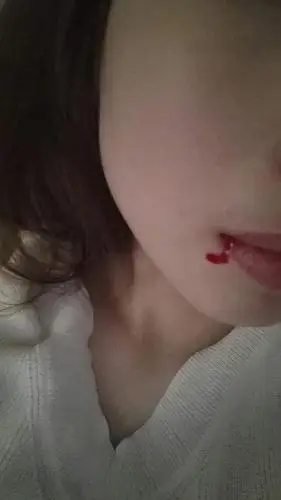 吓死宝宝了,嘴角留血