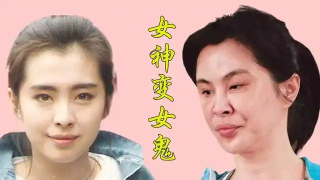 女星整容失败前后对比王祖贤脸部变形判若两人张檬取出假体颜值回归