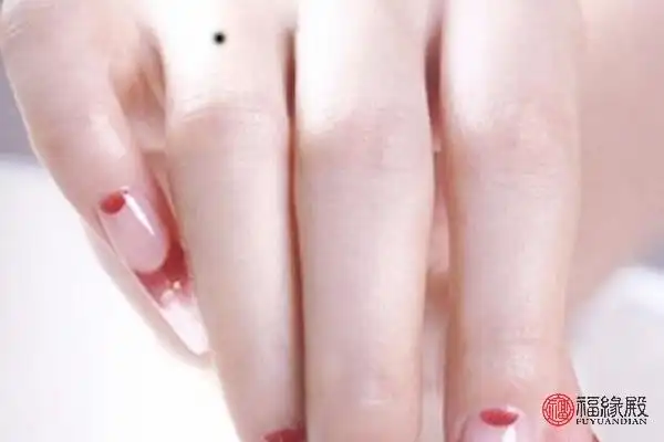 无名指有痣代表什么