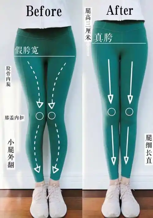 妇科病不常见股骨颈干角变化(几乎不可逆)股骨大转子突出兼组织增生