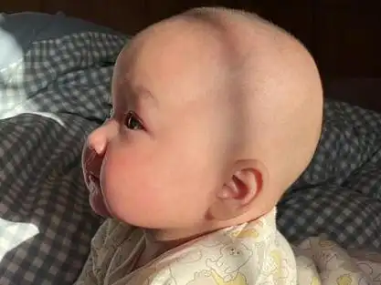 今天出去被人说宝宝头型丑,说丑就算了,还说我们舟状头,尖头,说扁头