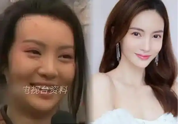 质疑之声如潮水般涌现,其中最为普遍且尖锐的,莫过于对金晨是否整容的