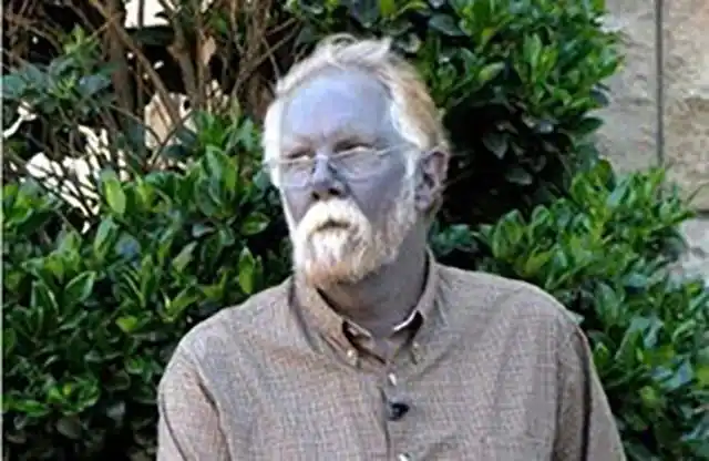 世界上绿种人仅剩3000,血是绿色的,他们只靠光合作用能活下去吗