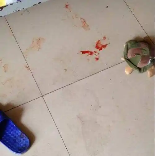 推门就看见客厅有一摊血迹你这是肿么了我的哈