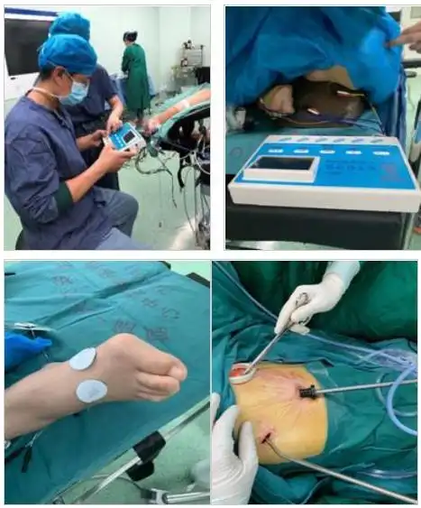 一附院完成全国首例自主呼吸针刺复合麻醉下